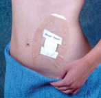 點(diǎn)擊放大 洗浴貼-骨科耗材